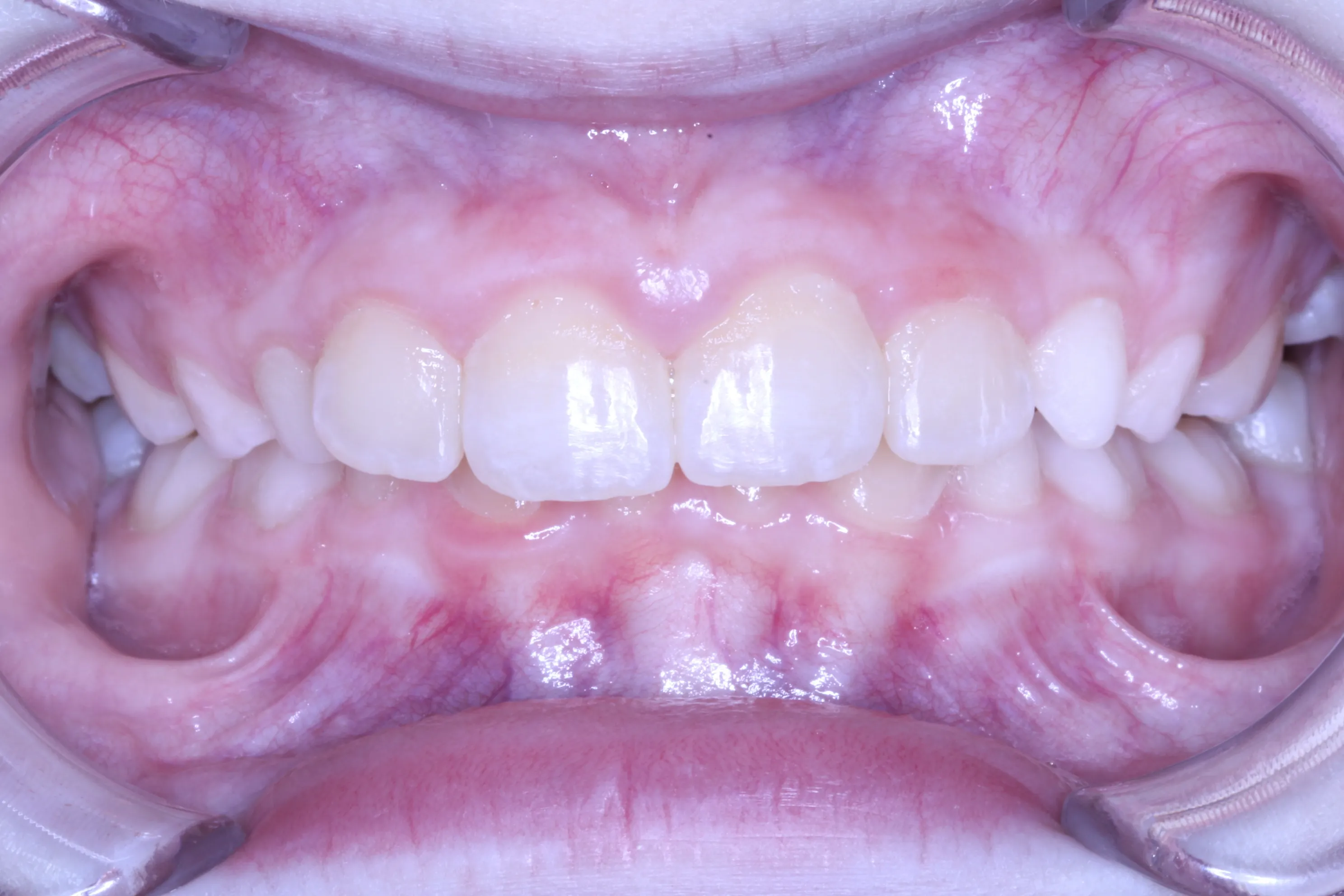 smile-gallery gallery